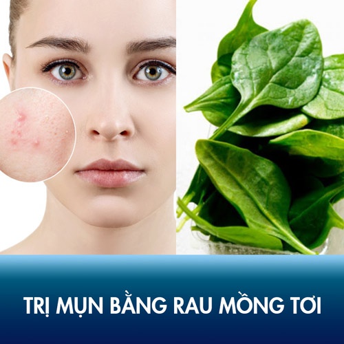 Công thức trị mụn trứng cá, mụn đầu đen, mụn ẩn hiệu quả